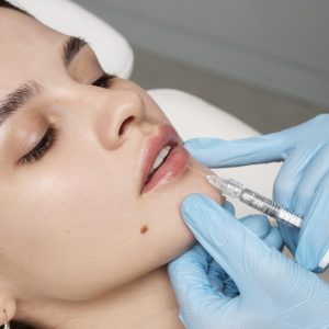 close-up-woman-getting-lip-fillers close-up-woman-getting-lip-fillers